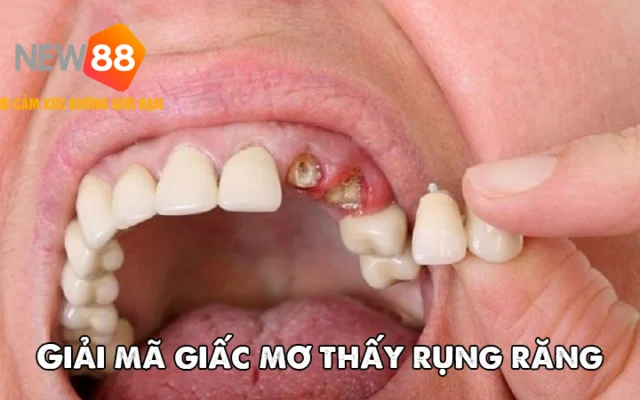 Giải Mã Giấc Mơ Nằm Mơ Thấy Rụng Răng – Điềm Gì Đang Đến Với Bạn?